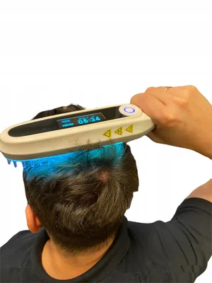 Obrázok produktu pre Uvb lampa Psoriáza, vitiligo, ekzém Akné Svetelná terapia 311Nm