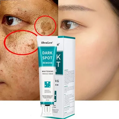 Produktbild von iBeaLee Pigmentflecken Creme 20 ml – Pflege für dunkle Flecken & ungleichmäßigen Hautton