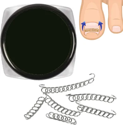 Obrázek produktu pro Sada pro korekci zarostlých nehtů