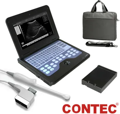 Produktbild von CMS600P2 Tragbarer Ultraschallscanner 10,1" Digital-LCD-Diagnosesystem mit transvaginaler Sonde Schwarz-weißes Ultraschallgerät