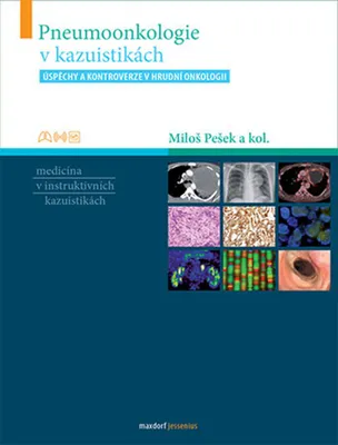 Obrázek produktu pro Pneumoonkologie v kazuistikách (kolektiv autorů)