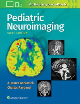 Immagine prodotto di Pediatric Neuroimaging