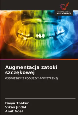 Produktbild von Augmentacja zatoki szcz¿kowej