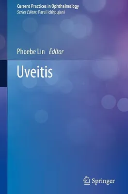 Produktbild von Uveitis