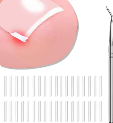 Produktbild von 51-teiliges schmerzfreies Nagelglättungsset mit Nagelheber – einfaches Werkzeugset für eingewachsene Zehennägel