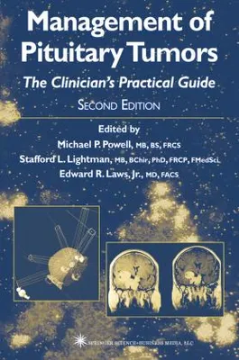 Zdjęcie produktu dla Management of Pituitary Tumors