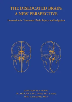 Produktbild von The Dislocated Brain
