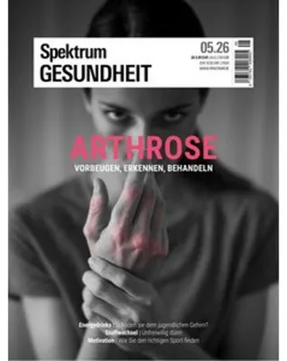 Obrázok produktu pre Spektrum Gesundheit 5/2026 - Arthrose