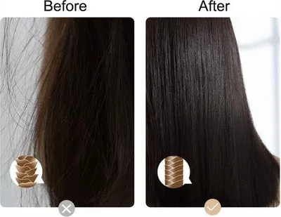 Image de Unyqoos® To – Produit (Modèle H)