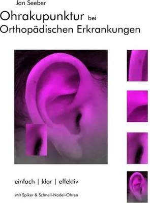Obrázek produktu pro Ohrakupunktur bei Orthopädischen Erkrankungen