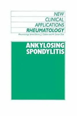 Obrázok produktu pre Ankylozujúca spondylitída