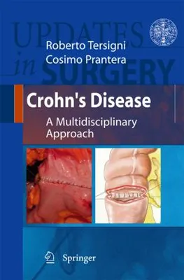 Obrázek produktu pro Crohn's Disease