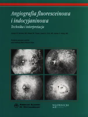 Image de Angiographie à la fluorescéine et à l'indocyanine