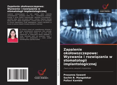 Produktbild von Zapalenie okolowszczepowe