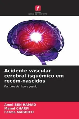 Produktbild von Acidente vascular cerebral isquémico em recém-nascidos