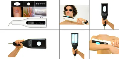 Obrázok produktu pre Profesionálna veľká lampa jadro uvb 311nm uvb lampa psoriáza psoriáza vitiligo ekzém akné svetelná terapia