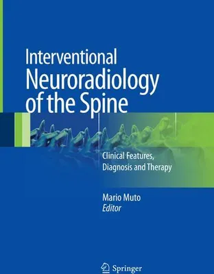 Obrázok produktu pre Interventional Neuroradiology of the Spine
