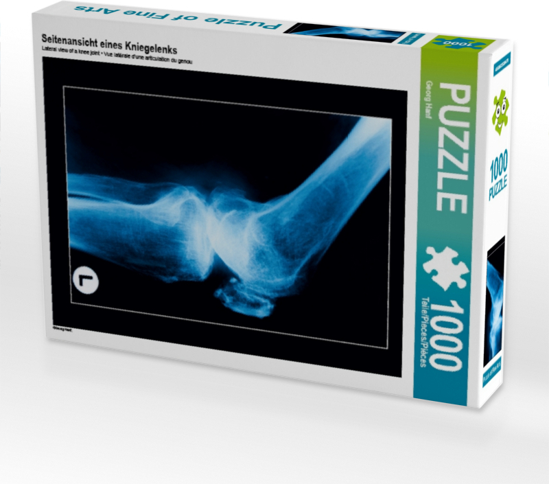 Calvendo Seitenansicht eines Kniegelenks 1000 Teile Puzzle hoch 480x640mm, Hanf Georg; 7331766