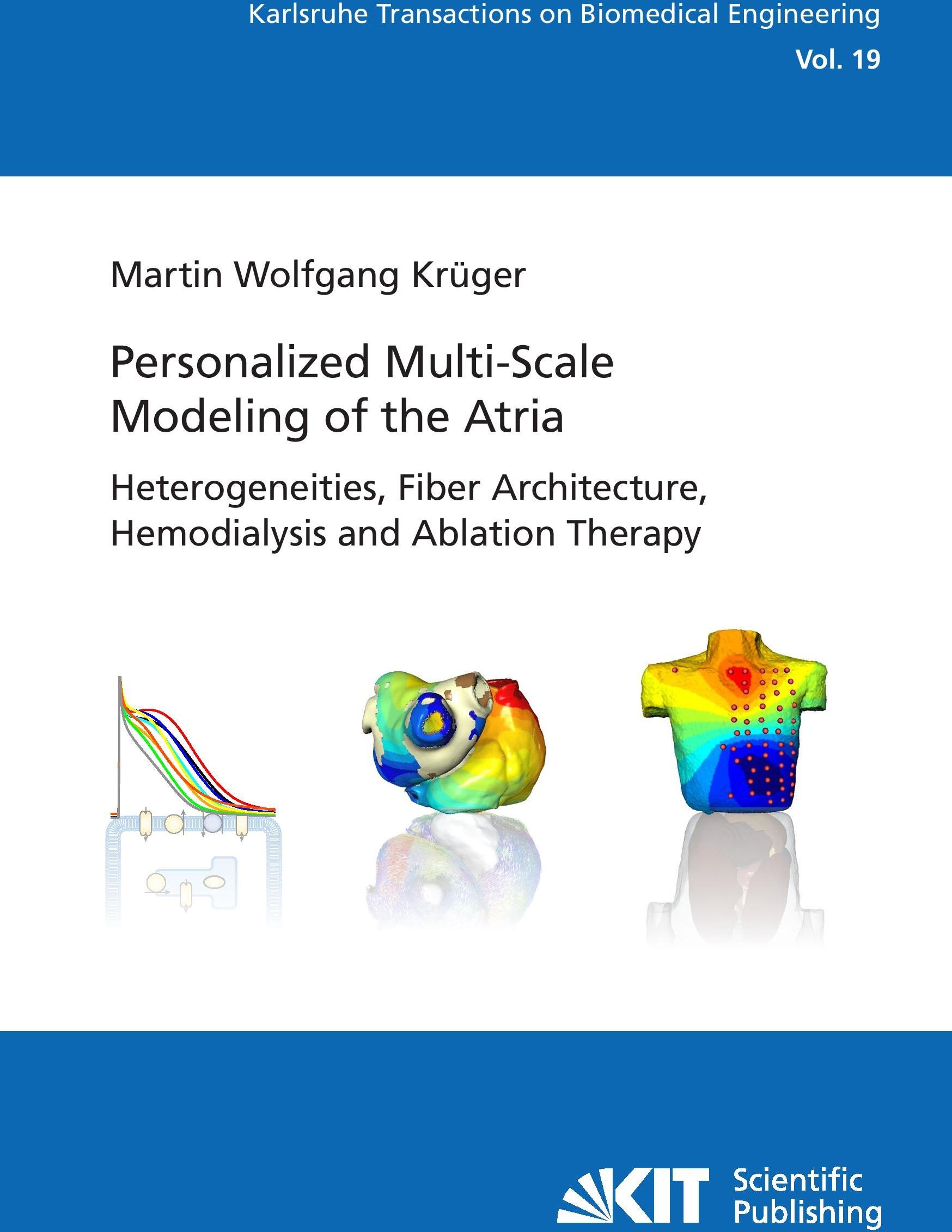Sonstige Verlage Personalized Multi-Scale Modeling of the Atria: Heterogeneities, Fiber Architecture, Hemodialysis and Ablation Therapy