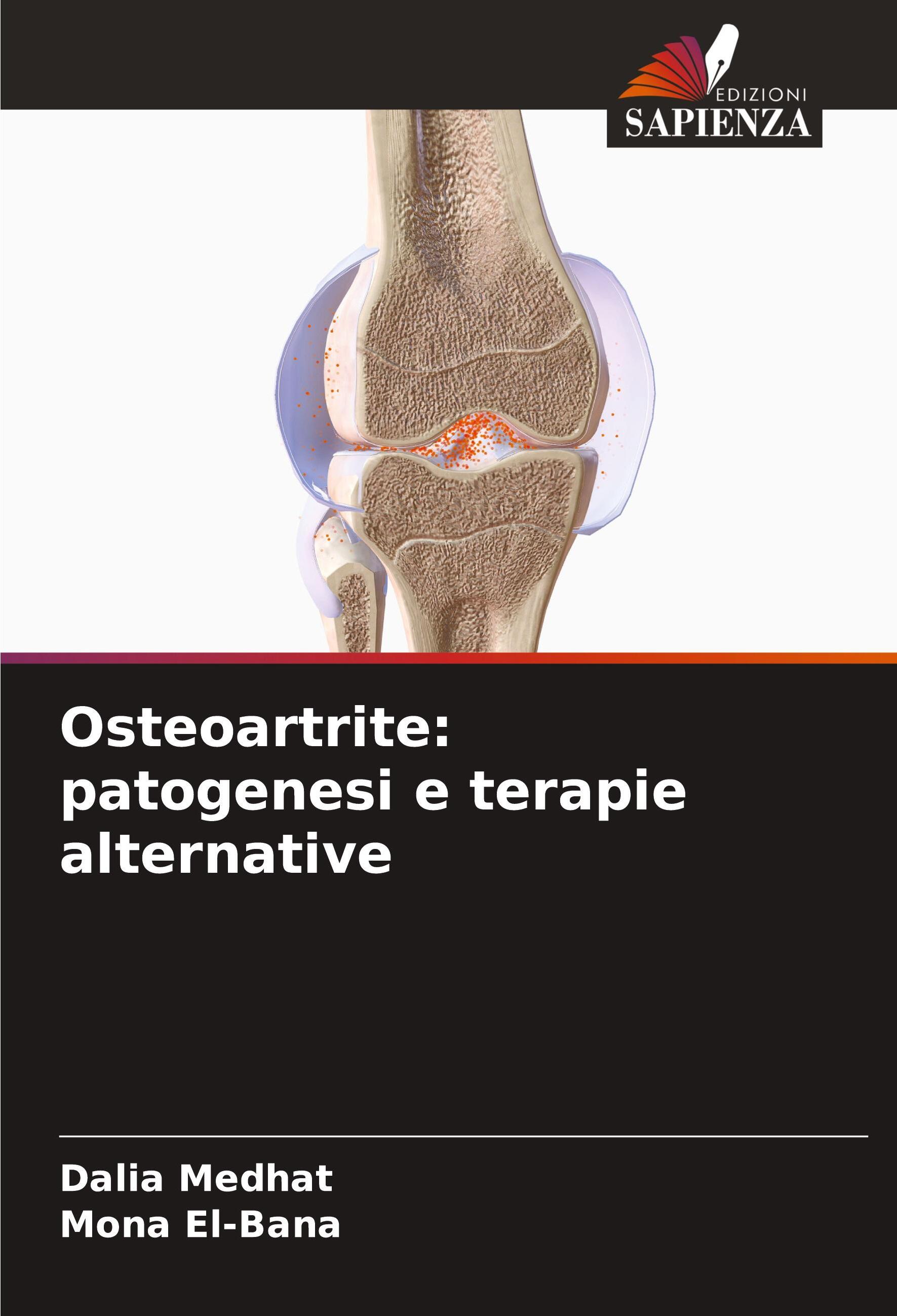 Sonstige Verlage Osteoartrite: patogenesi e terapie alternative