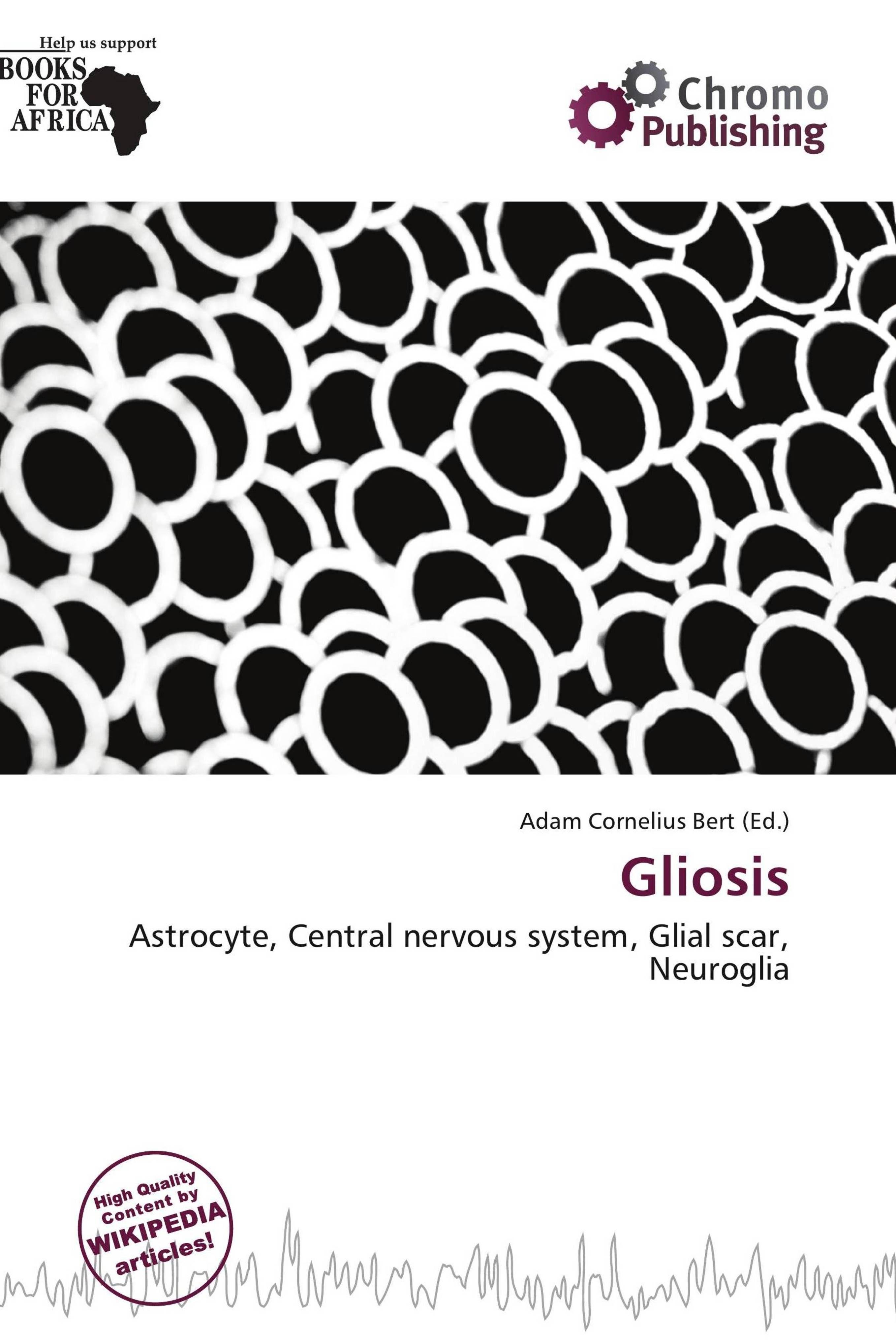 Sonstige Verlage Gliosis