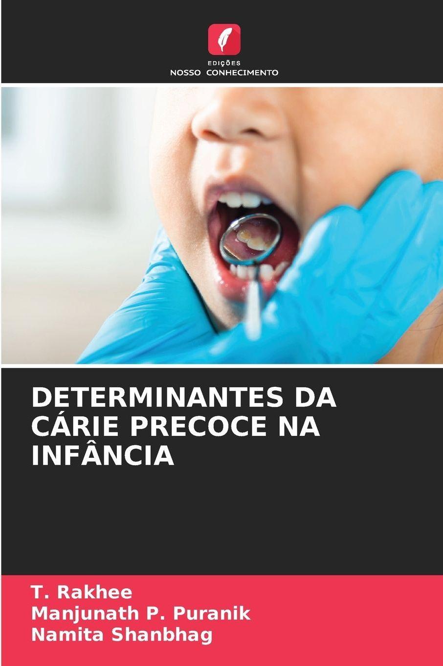 Edicoes Nosso Conhecimento Determinanten Der Frühkindlichen Karies