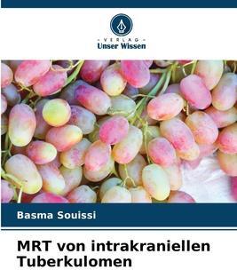 Sonstige Verlage MRT von intrakraniellen Tuberkulomen