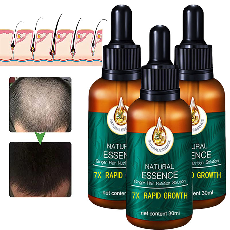 30ml Haarwachstum Serum, Anti-Haarausfall, 
