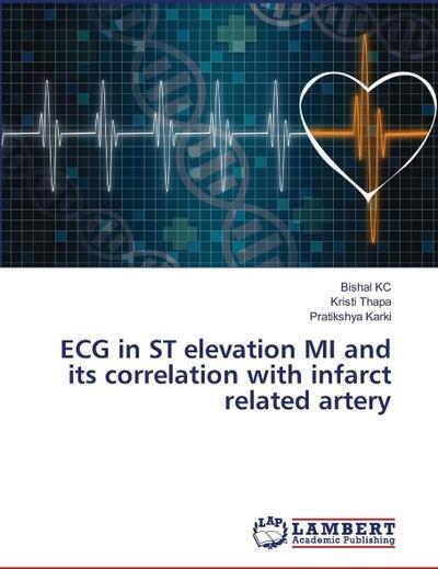 OMNISCRIPTUM ECG in ST elevation MI and its correlation with infarct related artery