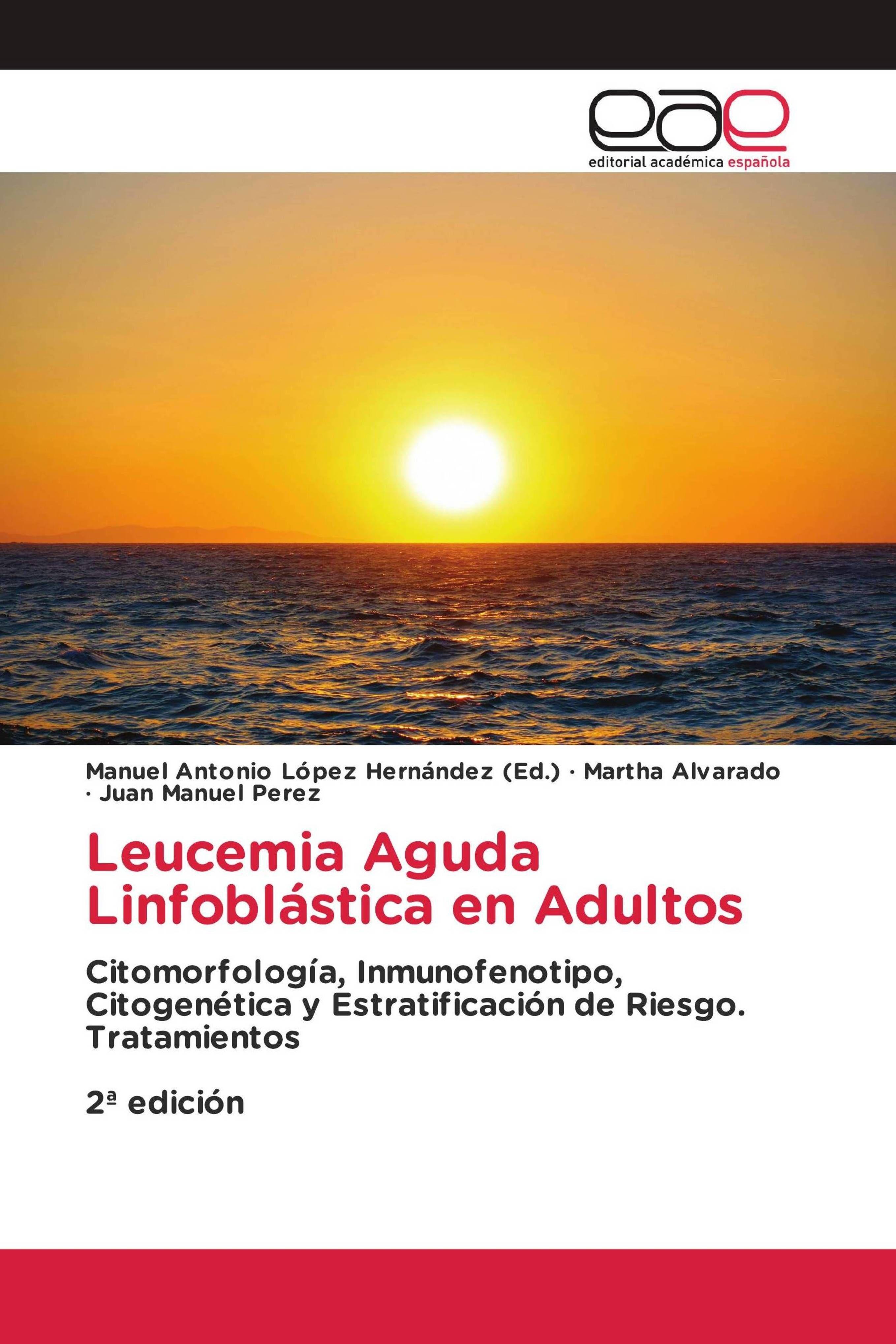 Sonstige Verlage Leucemia Aguda Linfoblástica en Adultos