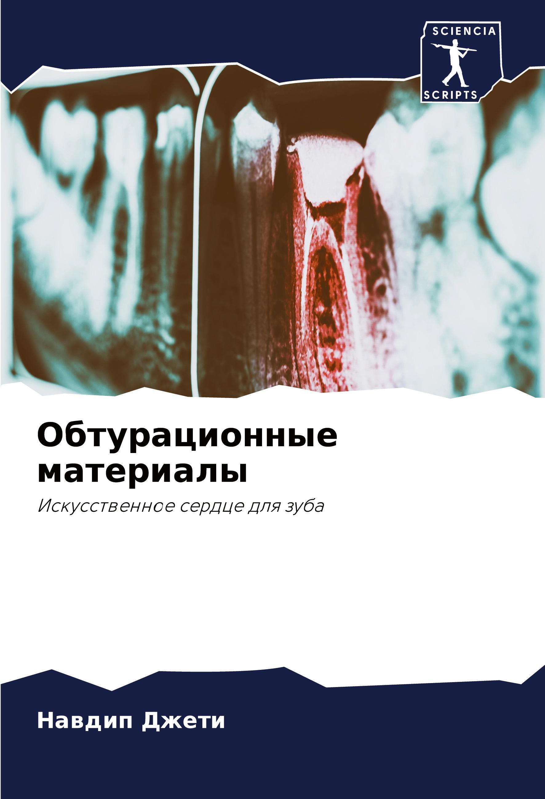 Sonstige Verlage Obturacionnye materialy