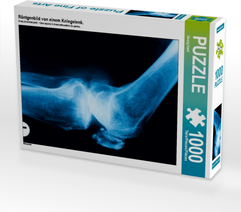 Calvendo Röntgenbild von einem Kniegelenk. 1000 Teile Puzzle hoch 480x640mm, Hanf Georg; 7320424