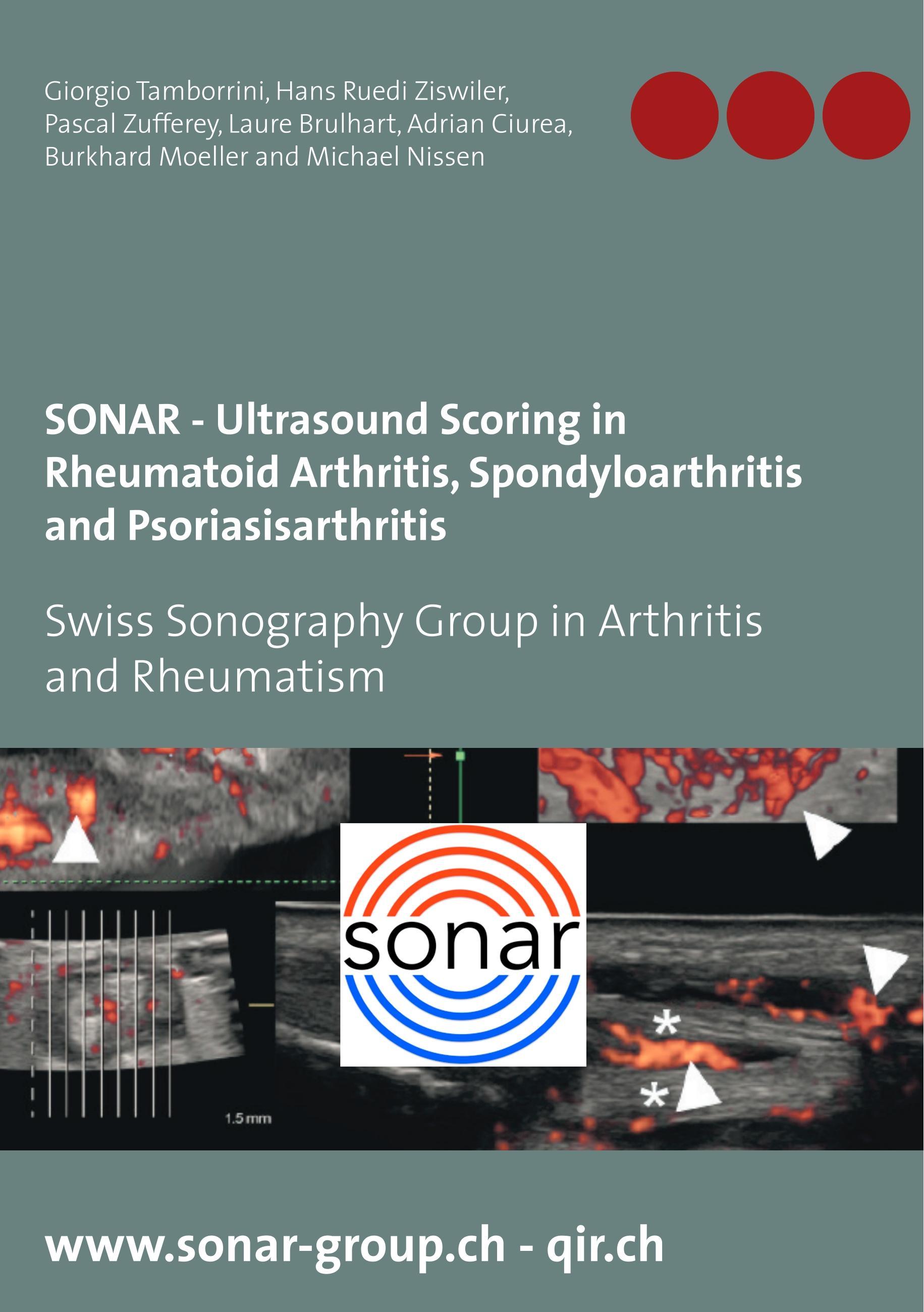 Bod - Books On Demand SONAR - Ultraschall-Scoring bei rheumatoider Arthritis, Spondyloarthritis und Psoriasisarthritis