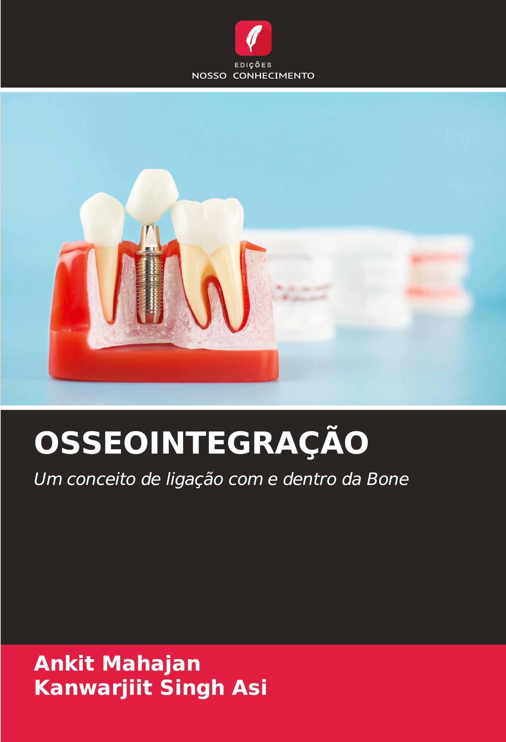 Sonstige Verlage Osseointegração