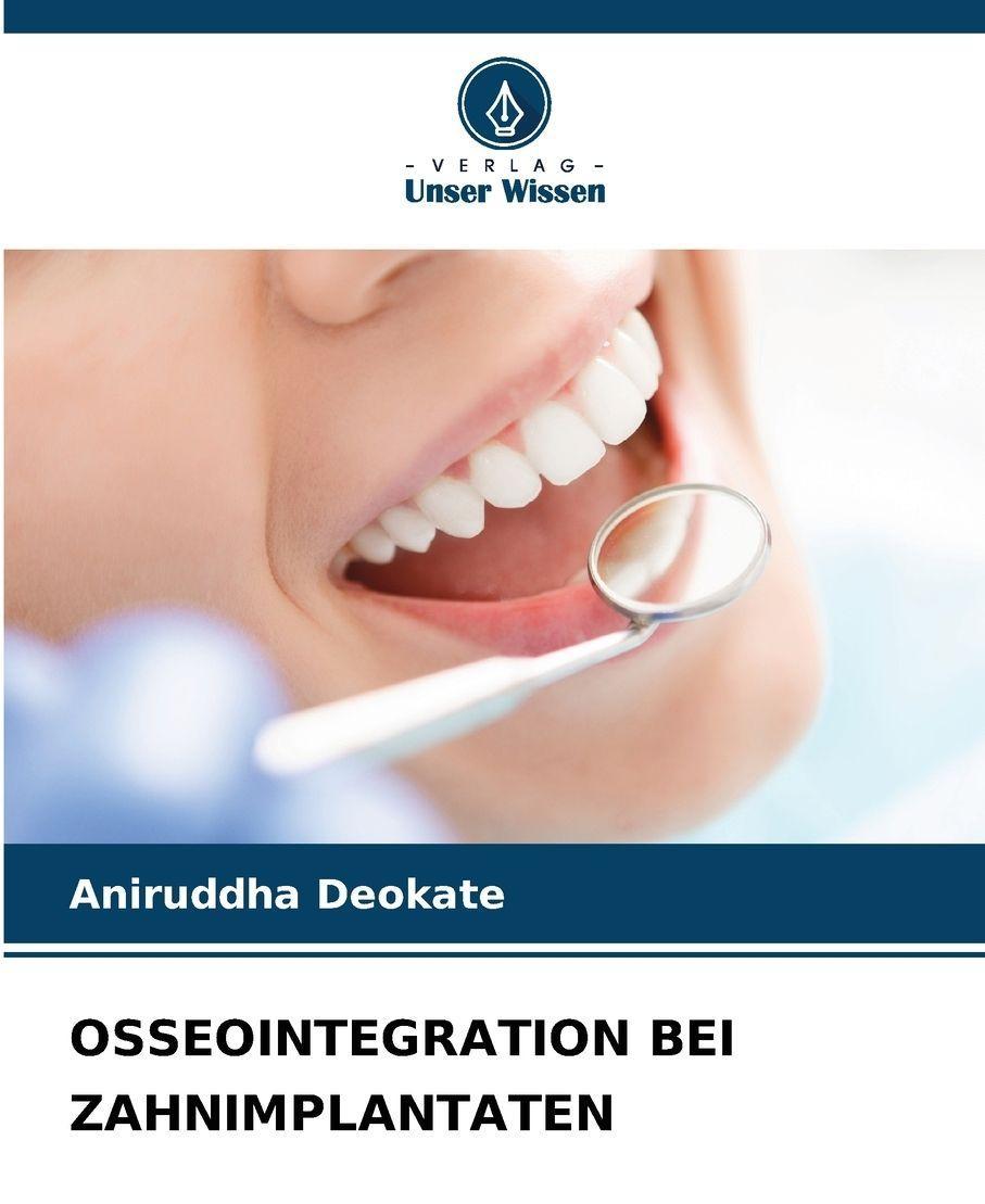 Sonstige Verlage Osseointegration Bei Zahnimplantaten