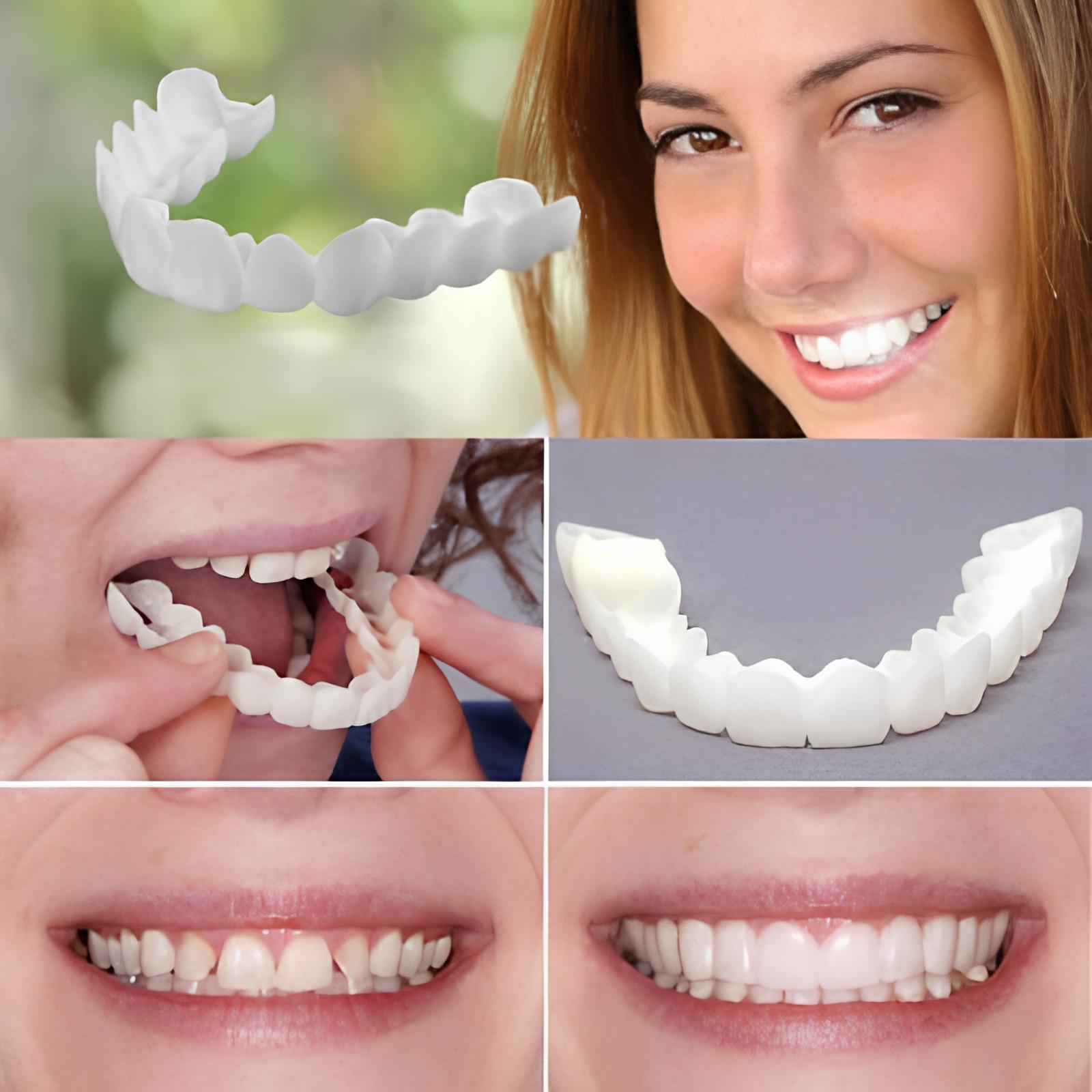 RESTEQ Zahnärztliche Snap-on-Smile-Verblendungen 1 Stück (Set oben und unten) BLPKEU1HS5