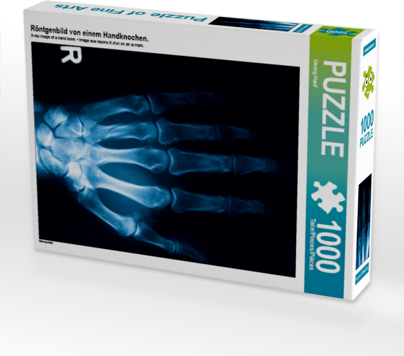 Calvendo Röntgenbild von einem Handknochen. 1000 Teile Puzzle hoch 480x640mm, Hanf Georg; 7320445