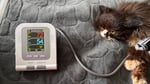 Katze Nierenkrank, Blutdruck variiert 