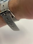 Armband löst sich