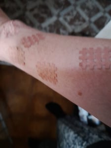 Health Press® Gittertape Cross Tape – Größe Typ C 40 Stück – Akupunkturpflaster mit ausführlicher E-Book Anleitung zum Download Kunden-Foto 2