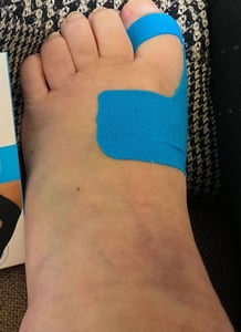 SANMEDIX Hallux Valgus Tape – 20 vorgeschnittene Kinesiologie-Tapes, Blau & Schwarz Kunden-Foto 2
