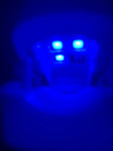 Nagelpilz Laser Behandlungsgerät, Nagelpilz Behandlung für Zehennagel, mit 470nm Blau Licht+910nm Infrarotlicht Kunden-Foto 2