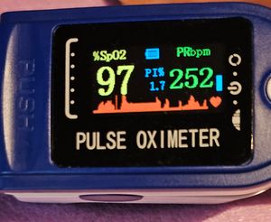 Pulsoximeter für den Finger zur Pulsmessung und Sauerstoffsättigung FÜR DEN FINGER Kunden-Foto 4