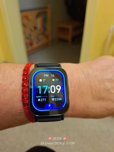 Xiaomi Redmi Watch 5 Lite Gold, Smartwatch, 1,96″ Display, Bluetooth‑Anrufe, 5 ATM Kunden-Foto 2