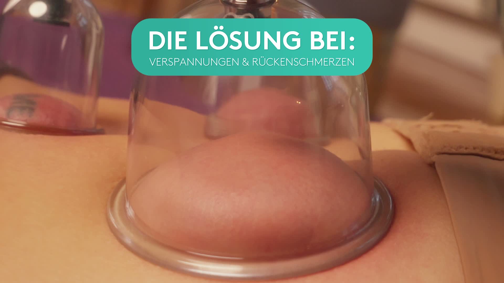 KURGLAS [Original] Schröpfgläser mit Vakuumpumpe [24 Stück] Produktbild-Vorschau 7