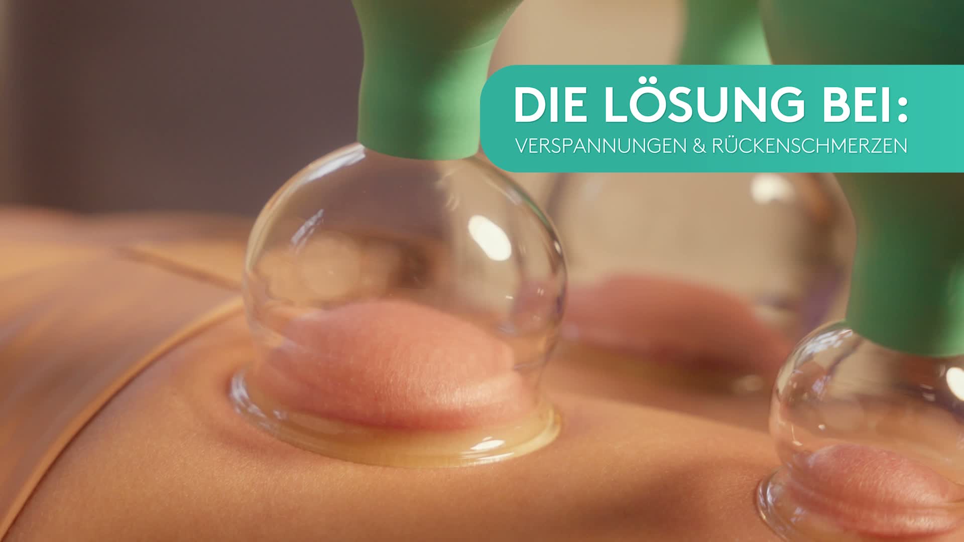KURGLAS Schröpfgläser aus Echtglas [5 Stück] – Produktbild-Vorschau 7