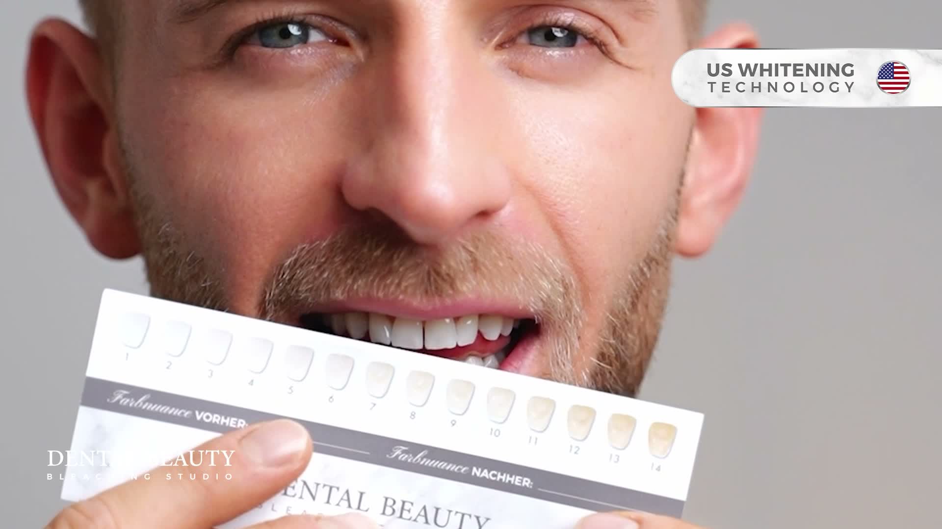 Dental Beauty Zahnbleaching Set Rapid+ | All in One Teeth Produktbild-Vorschau 7