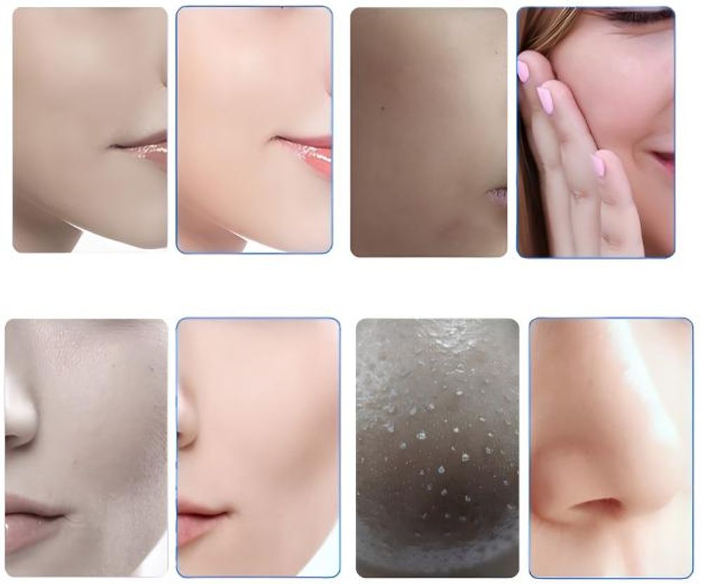 Hydradermabrasion 6 en 1 Nettoyage à l'Hydrogène et Infusion d'Oxygène - Appareil de Soin du Visage