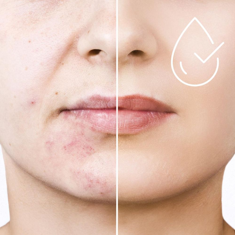 Maska Led Do Terapii Światłem Neno Beauty Alva