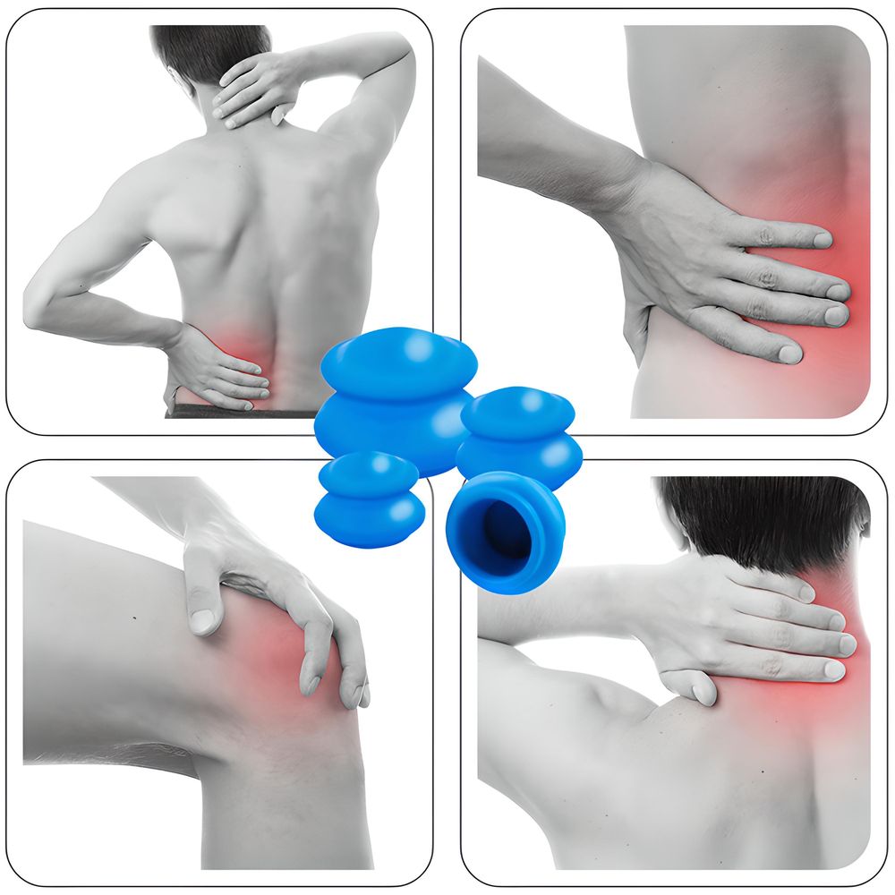 4er Schröpfen Set mit Schröpfgläser aus Silikon Pumpe Hochwertige Vakuum Massage Vakuumpumpe Cupping Schröpfglas Anti Cellulite Cups Retoo